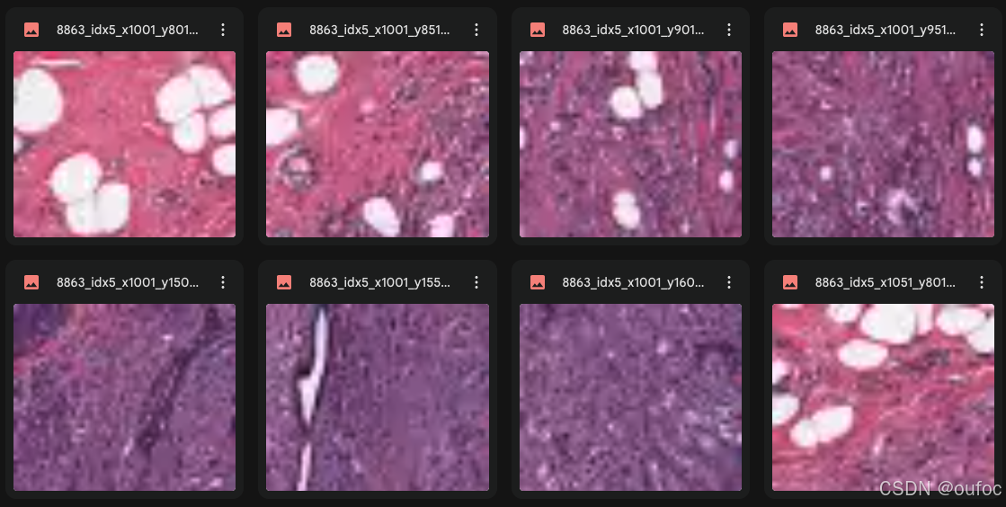 第J3-1周：DenseNet算法实现乳腺癌识别