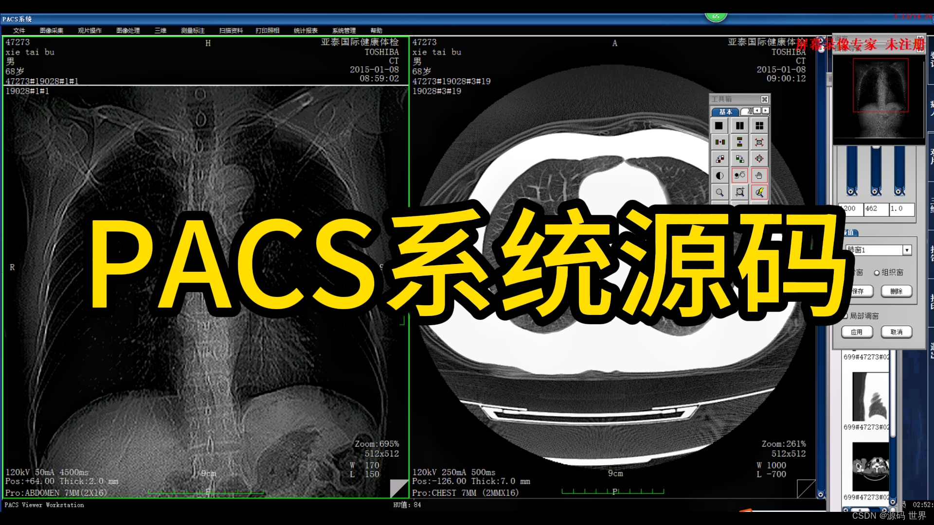（源码）一套医学影像PACS系统源码 医院系统源码 提供数据接收、图像处理、测量、保存、管理、远程医疗和系统参数设置等功能